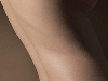 article_47_Discopatialombara-lumbagosilombosciatica.gif