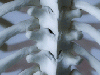 article_47_Reumatismeledegenerative-artrozasispondiloza.gif