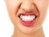 dental_bruxism.jpg