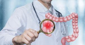 Sindromul de hipermotilitate intestinala Sindromul de hipermotilitate intestinala