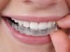 smile_factory_aparat.jpg