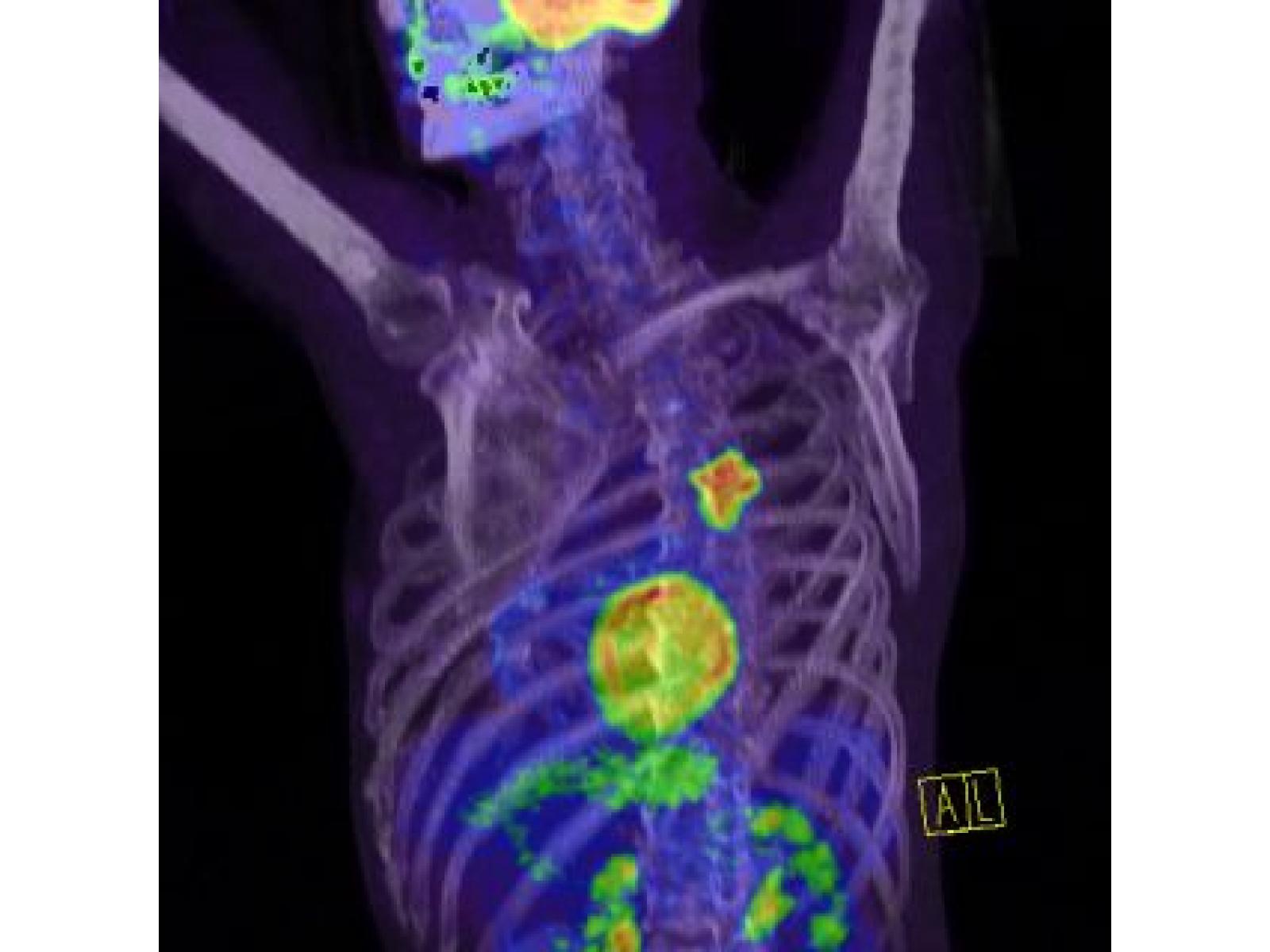 Centrul de Diagnostic Pozitron Diagnosztika PET CT - PETCT_lelet_redimensionata.jpg