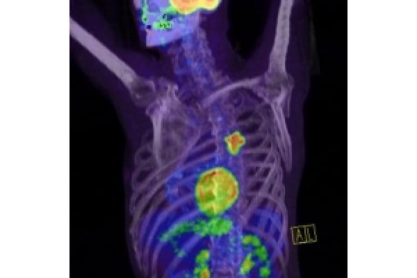 Centrul de Diagnostic Pozitron Diagnosztika PET CT - PETCT_lelet_redimensionata.jpg