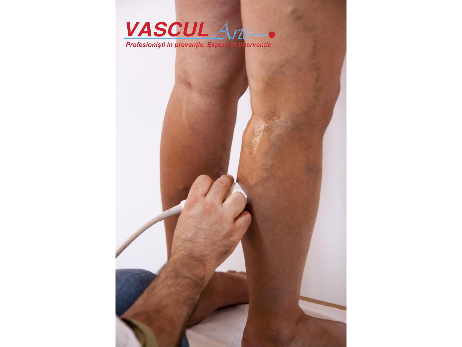 CLINICA VASCUL ARTE - IMG_2023.jpg