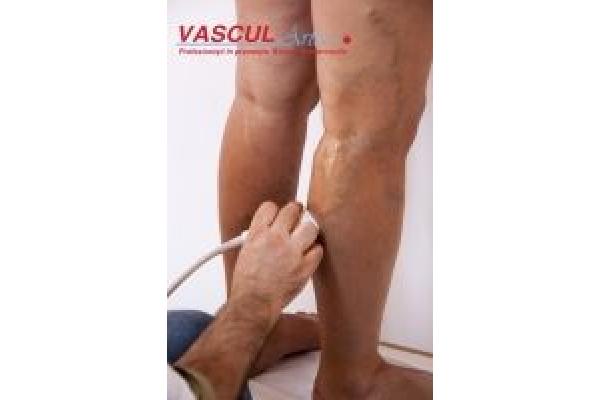 CLINICA VASCUL ARTE - IMG_2023.jpg