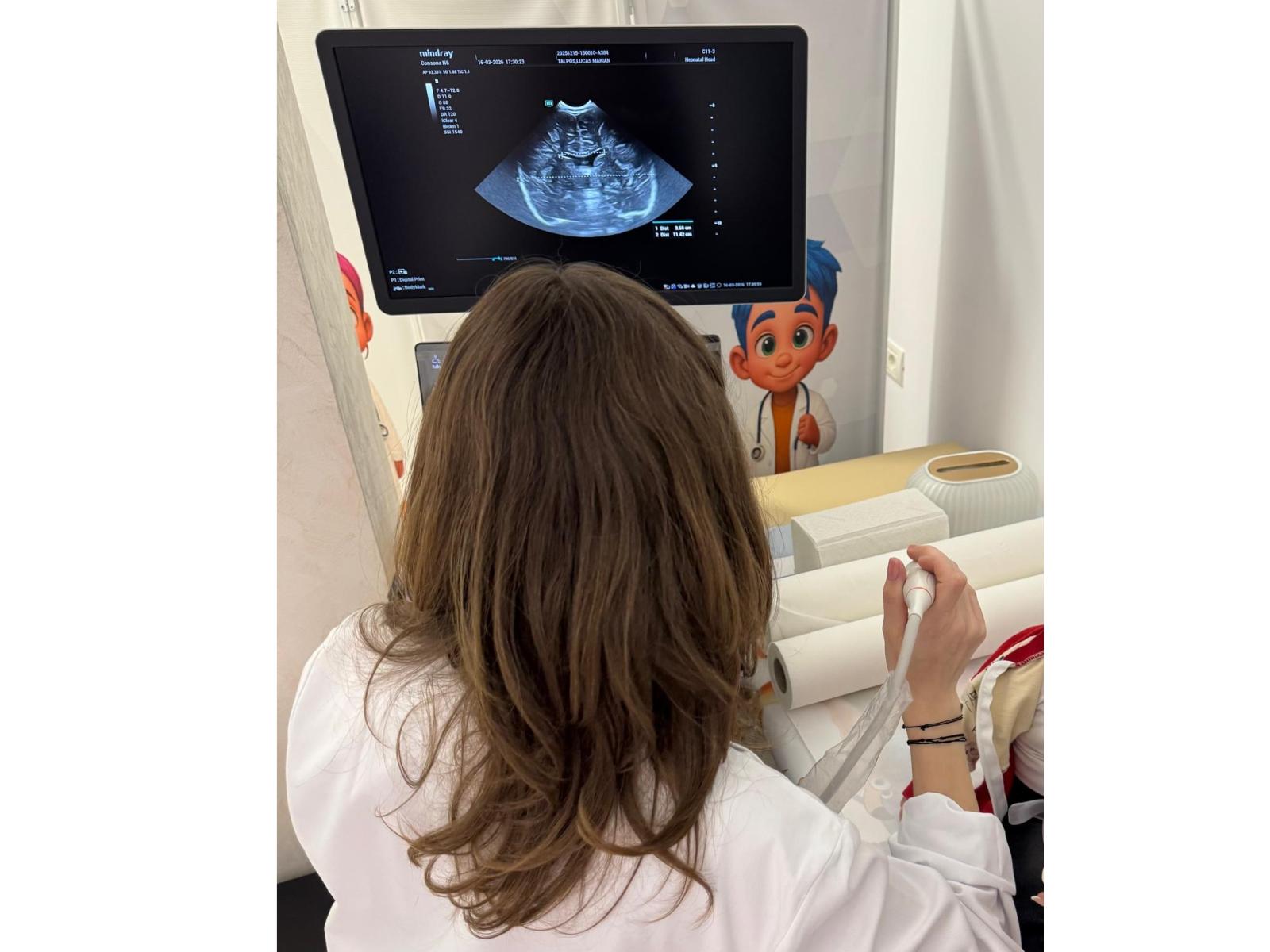 Armina ClinicMed - ecografie-transfontanelara-neonatala.jpg