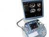 Voluson E6 - Multidisciplinar Doppler Color 3D/4D GE