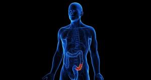 Diverticuloza si diverticulita: Simptome, Tratament, Preventie