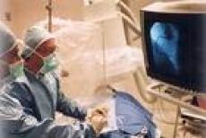 Tratamentul prin angioplastie si folosirea de stent