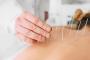 Beneficiile acupuncturii