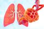 Explorarea bolilor rare pulmonare: prezentare, diagnostic si tratament