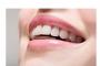 Bruxism - Intrebari frecvente referitoare la scrasnirea dintilor (bruxism)