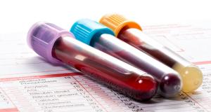 Pancitopenia - cauze, simptome si optiuni terapeutice