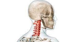 Siringomielia, o afectiune neurologica asociata cu malformatii congenitale ale creierului