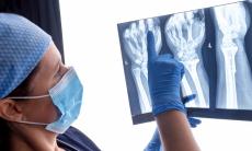 Transplantul de mana