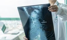 Diagnosticul si managementul tumorilor osoase benigne