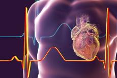 Tipuri de ablatie cardiaca si tratamentul acestora