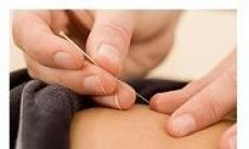 Acupunctura si beneficiile sale