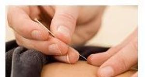 Acupunctura si beneficiile sale