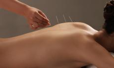 Cum functioneaza si ce este acupunctura?