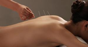 Cum functioneaza si ce este acupunctura?