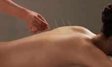 Argumente pro si contra acupuncturii