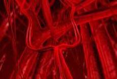 Embolismul pulmonar