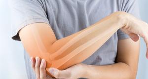  Artrita reumatoida - optiuni terapeutice