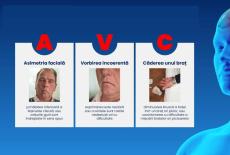 Cum recunosti rapid un accident vascular cerebral. Cele trei semne care salveaza vieti