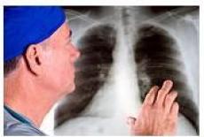 7 simptome ale bolilor pulmonare