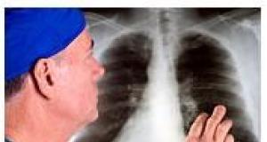 7 simptome ale bolilor pulmonare