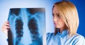 Barbatii romani, afectati de cancer pulmonar intr-o proportie alarmanta