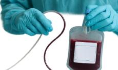 Recoltarea celulelor stem la nastere in contextul prematuritatii si al tipului de nastere: naturala vs. cezariana