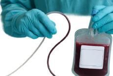 Recoltarea celulelor stem la nastere in contextul prematuritatii si al tipului de nastere: naturala vs. cezariana