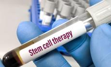 Celulele stem si bolile rare: o sansa reala de tratament