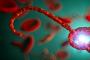 Ebola: simptome, cauze, tratament si preventie