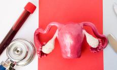 Cum functioneaza tratamentele naturiste pentru endometrioza?