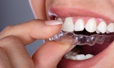 Bruxismul - cum iti sunt afectati dintii