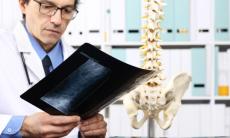 Tot ce trebuie sa stii despre hernia de disc
