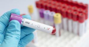 Simptomele infectiei cu HIV la femei