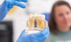 Implantul dentar cu incarcare imediata: cand este posibil si care sunt beneficiile reale
