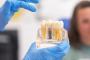  Implantul dentar cu incarcare imediata: cand este posibil si care sunt beneficiile reale