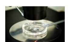 Inseminarea artificiala intratubara (ITI)