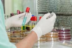  Markerii de depistare ai virusului Hepatitei B
