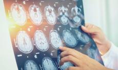 Aspecte ale ingrijirii persoanelor cu paralizie cerebrala