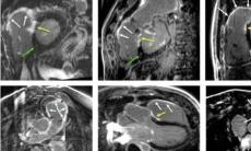 Cardio-RM-ul, cea mai complexa investigatie dedicata inimii si aplicatiile sale pentru pacientii din Romania