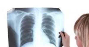 Prevenirea cancerului pulmonar la barbati 