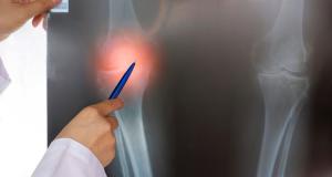 Investigatiile de rezonanta magnetica nucleara in afectiunile osteoarticulare 