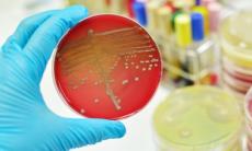 Stafilococul auriu si alte infectii stafilococice