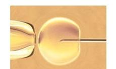 Transferul de blastocisti – Fertilizarea in vitro